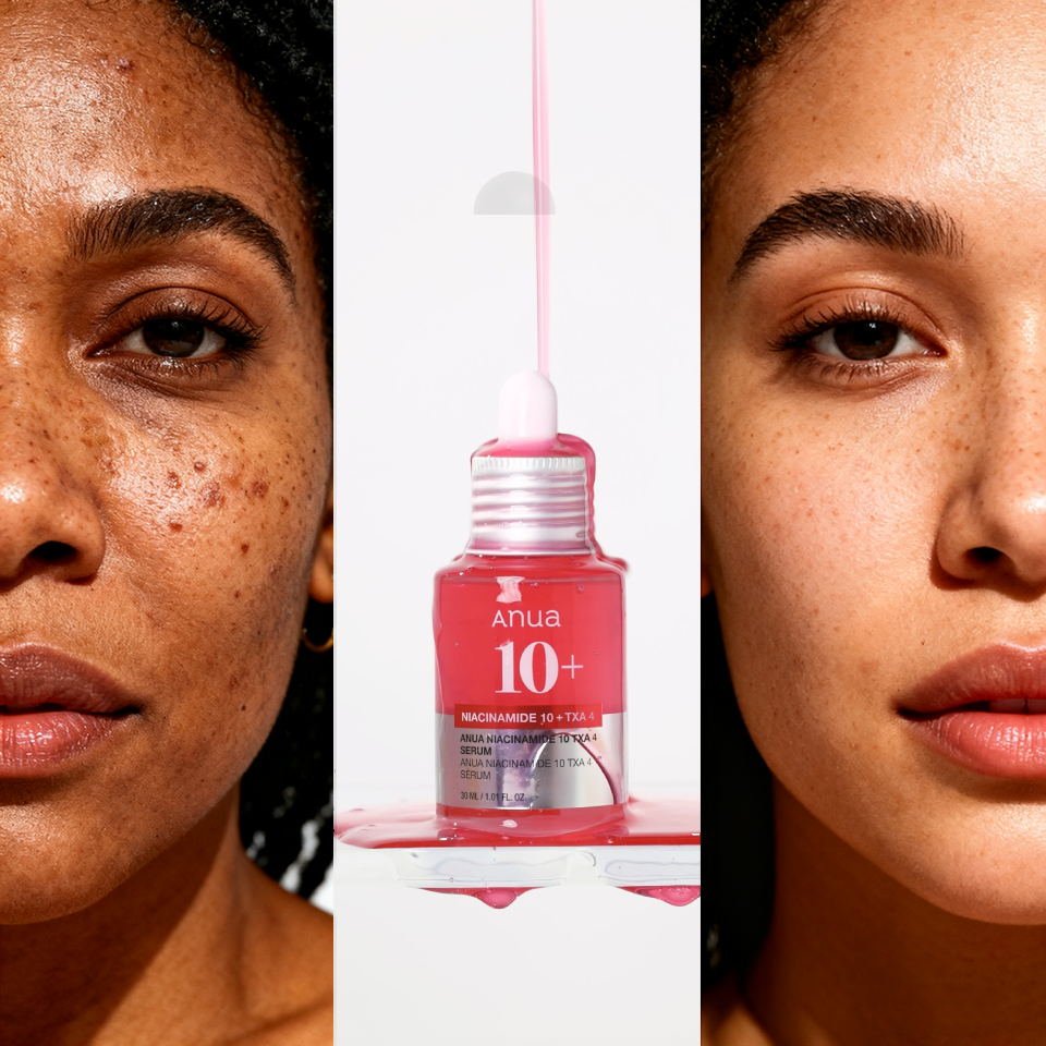 Sérum à la niacinamide 10% & TXA 4% pour glow le teint et atténuer les taches